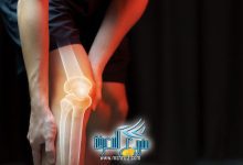 علاج آلام الركبة
