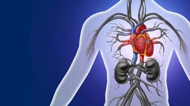 علاج متلازمة الوريد الأجوف السفلي