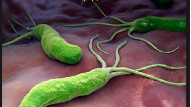 جرثومة المعدة الحلزونية اسباب واعراض الاصابه والعلاج