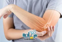 وصفات علاج هشاشة العظام